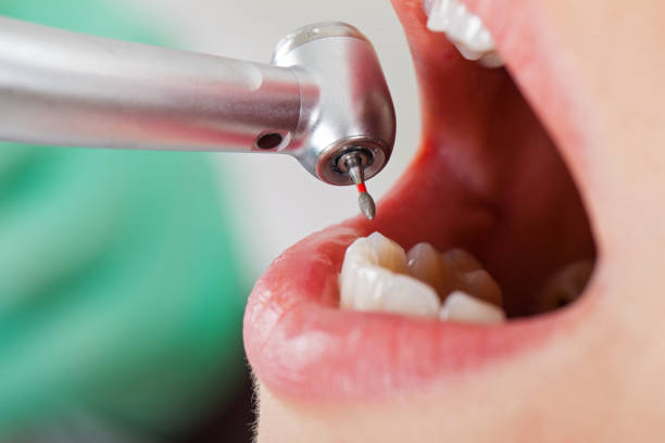 Best Cosmetic Emergency Dentistry in Robbinsdale, MN